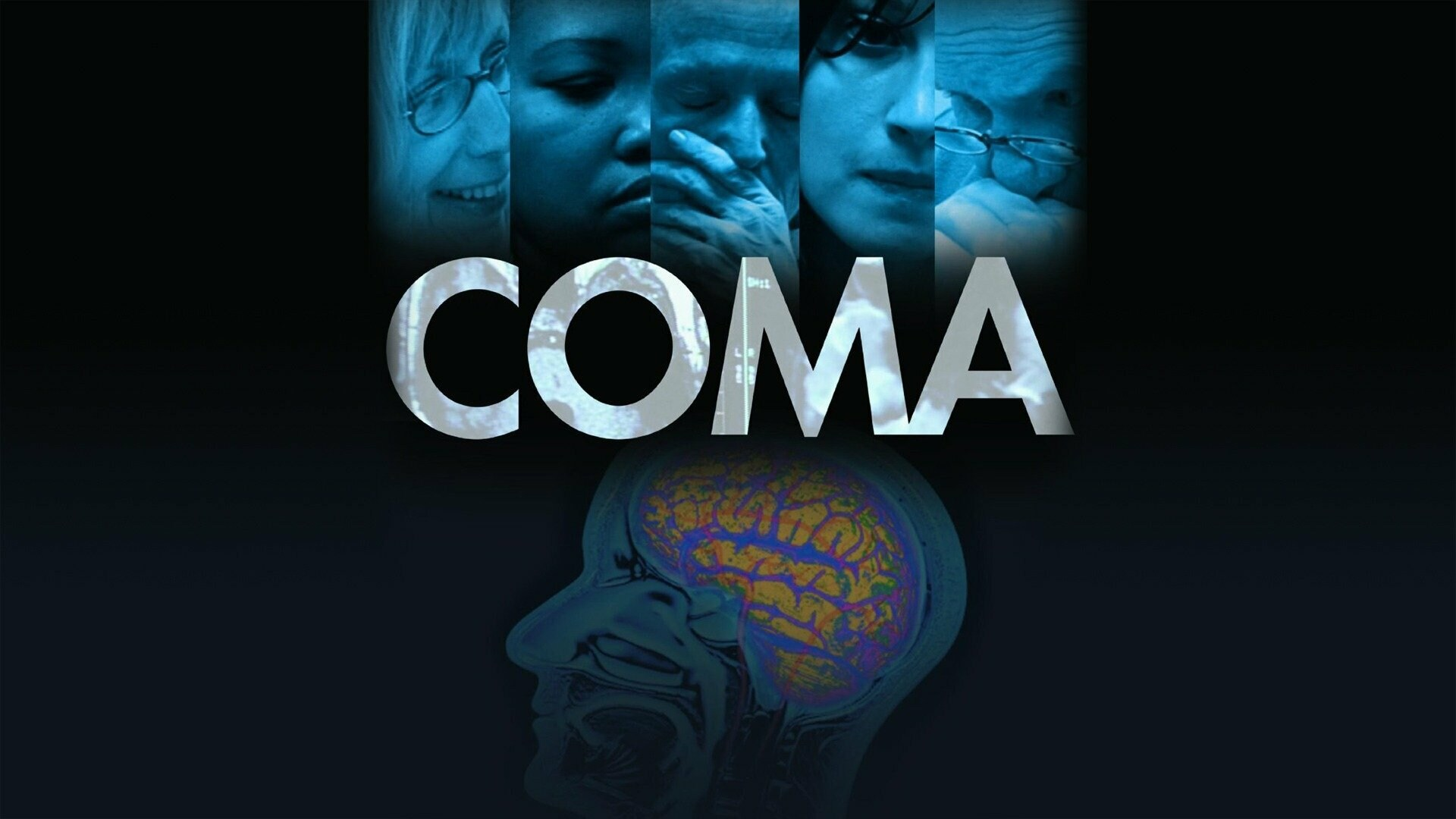 Coma